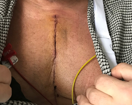 Achteraf bekeken, maar toen...